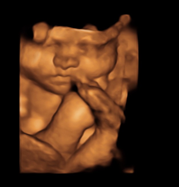 31 weeks 3d ultrasound